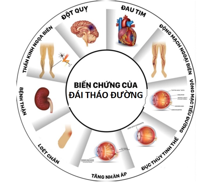 Đột quỵ ở người trẻ