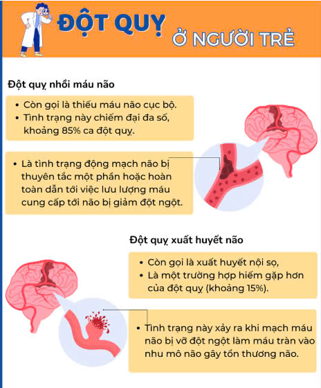 Đột quỵ ở người trẻ