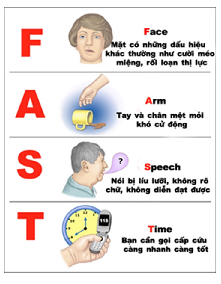 Quy tắc FAST