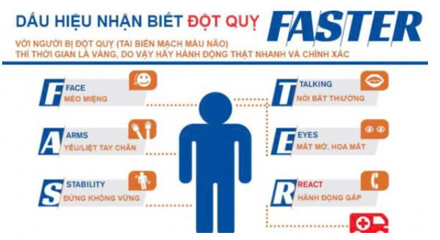 Quy tắc FAST