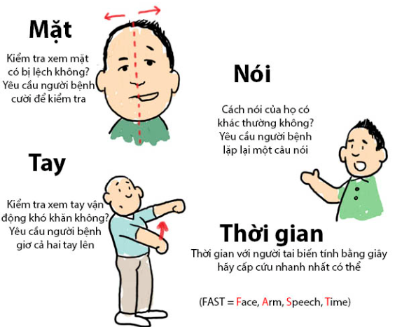 Tai biến mạch máu não ở người già