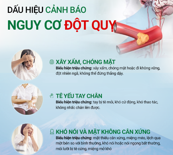 Đột quỵ khi ngủ