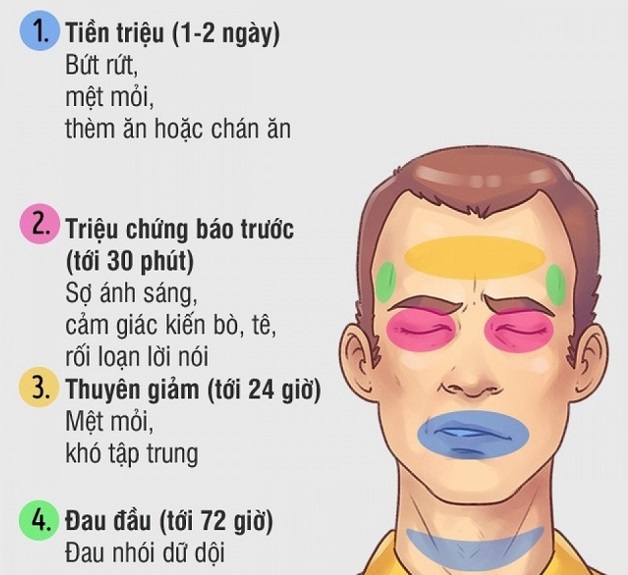 phân biệt đau nửa đầu và đột quỵ