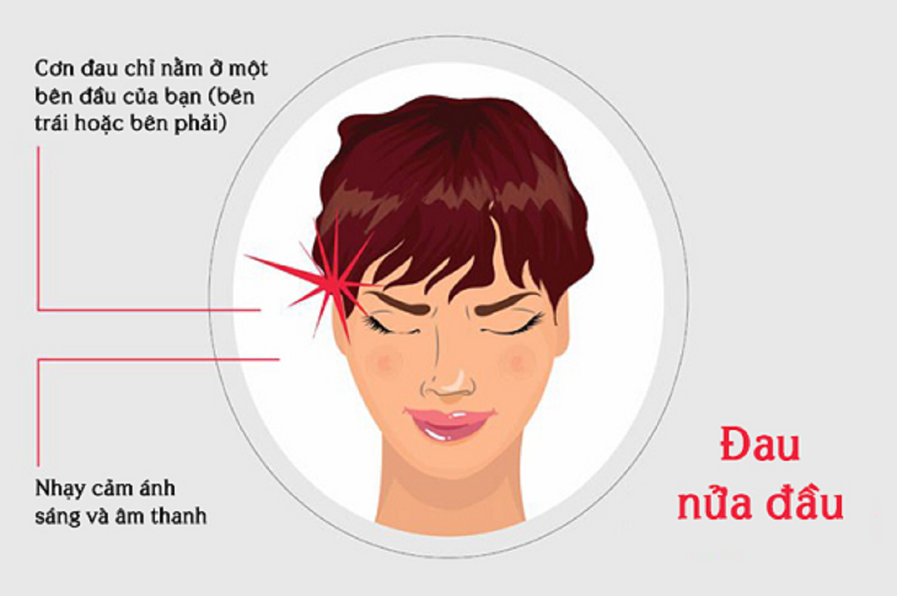 phân biệt đau nửa đầu và đột quỵ