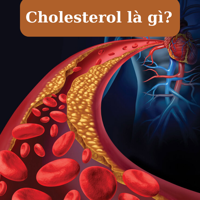 cách kiểm soát Cholesterol phòng ngừa đột quỵ