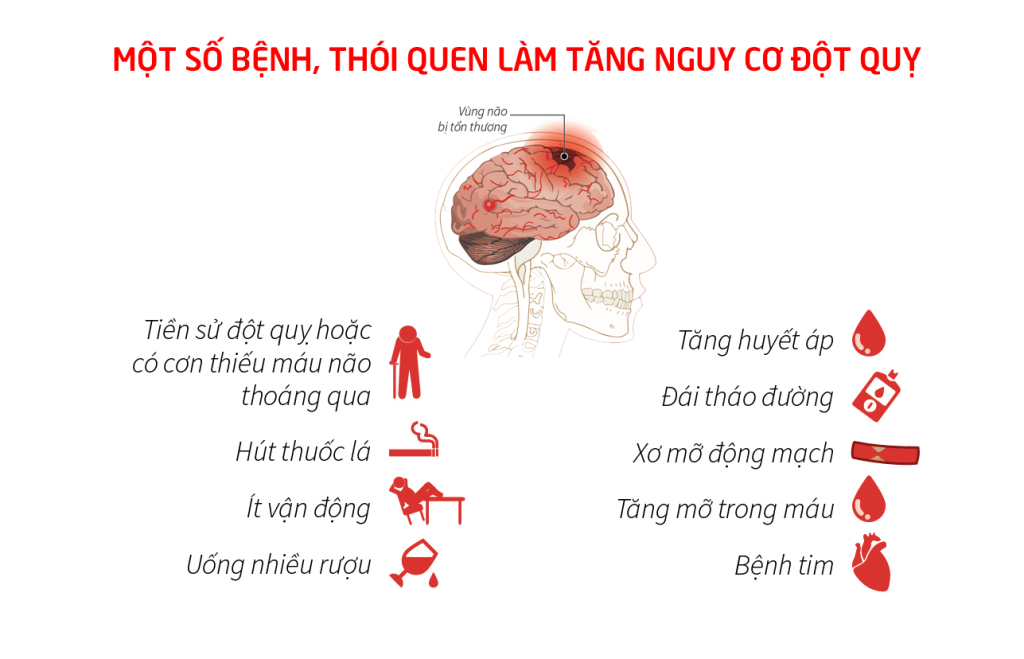 quan điểm sai lầm về đột quỵ