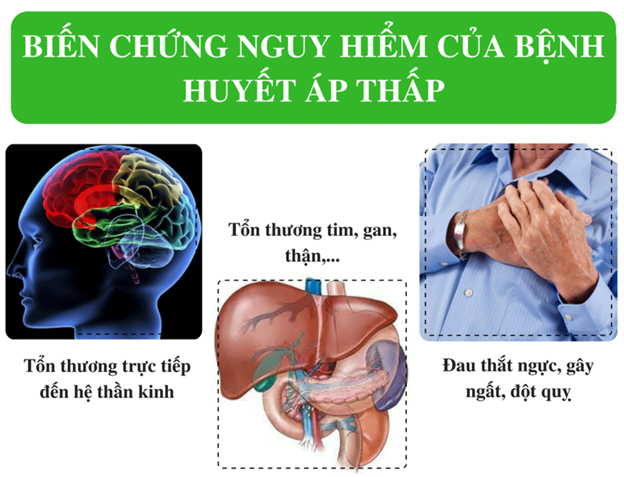 Huyết áp thấp gây đột quỵ