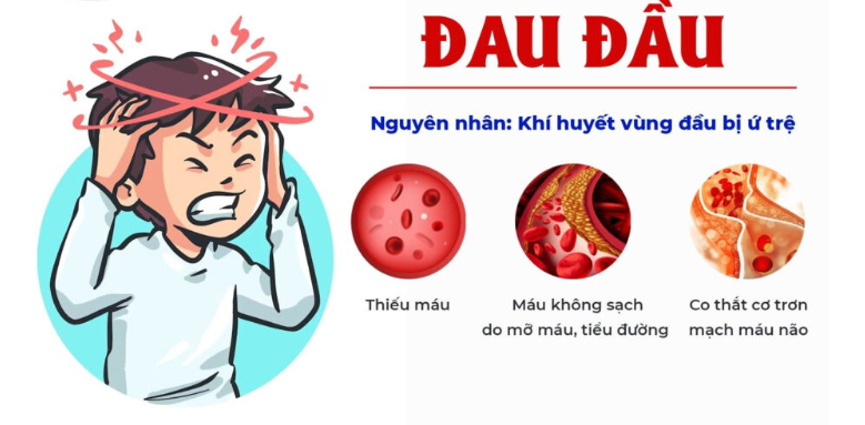 Đau đầu do thiếu máu não