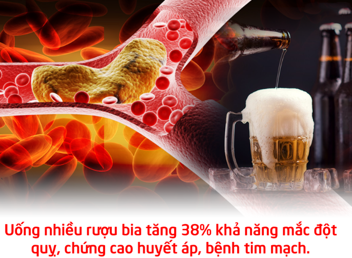 Tầm soát đột quỵ bao lâu 1 lần