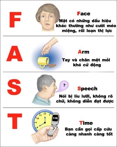 phân biệt đột tử và đột quỵ