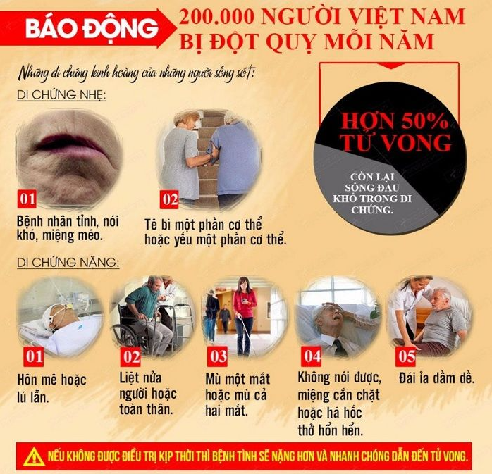Phương pháp phục hồi chức năng sau đột quỵ