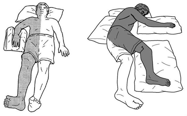 Tư thế nằm cho bệnh nhân liệt nửa người: Lời khuyên của bác sĩ chuyên khoa