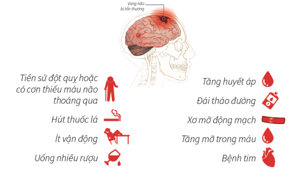 Phương pháp tầm soát tai biến mạch máu não