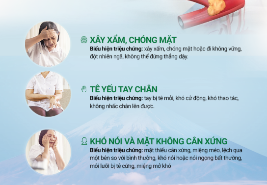 Co thắt mạch máu não