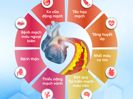 Rối loạn mỡ máu