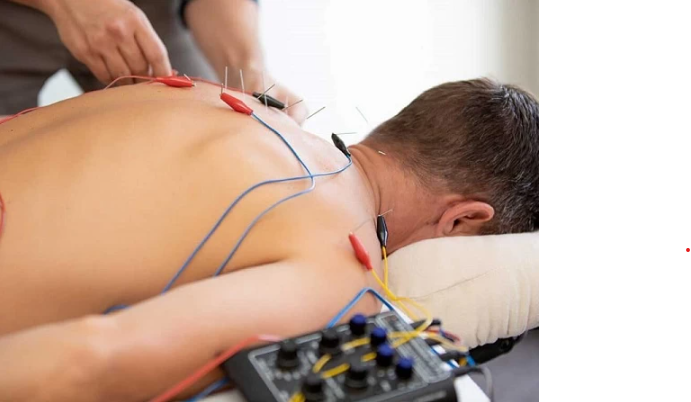 Bị tai biến mạch máu não có nên châm cứu không?