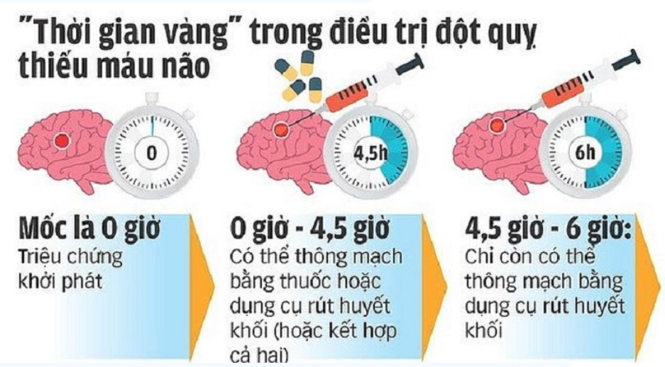 Đột quỵ có cứu được không?