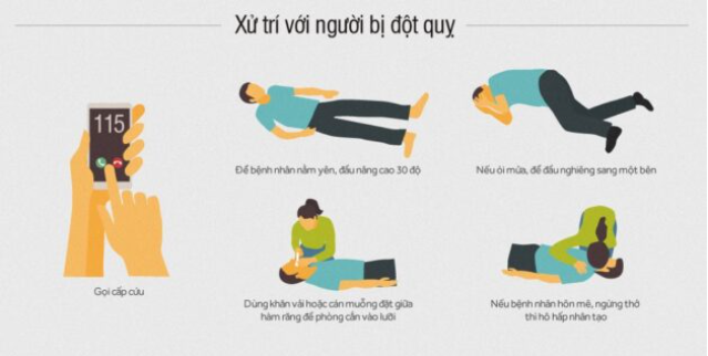 FAST đột quỵ