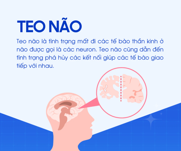 Teo não