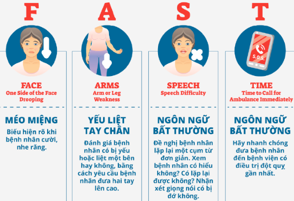Tắc mạch máu não có nguy hiểm không?