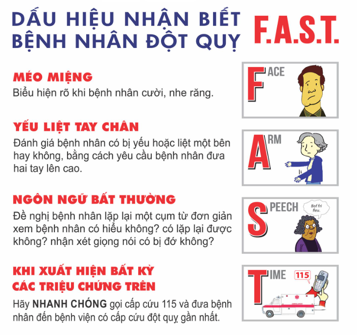 Các biện pháp phòng ngừa đột quỵ