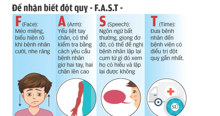 Nguyên nhân bị tai biến là gì?