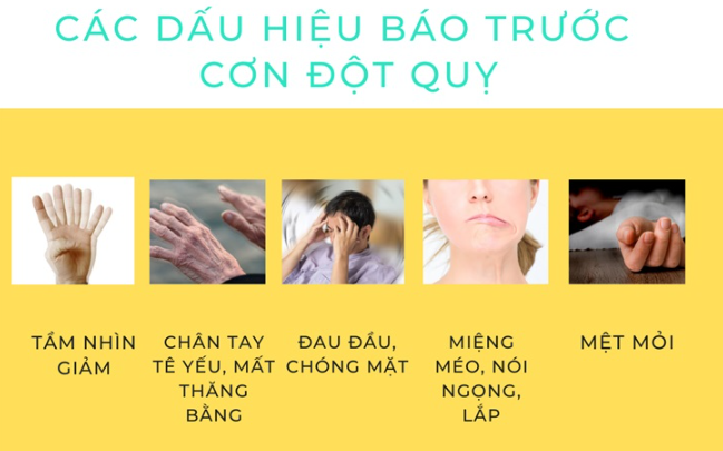 Dấu hiệu đột quỵ trước 1 tuần: Đừng chủ quan khi thấy những biểu hiện này