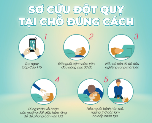 Dấu hiệu đột quỵ trước 1 tuần