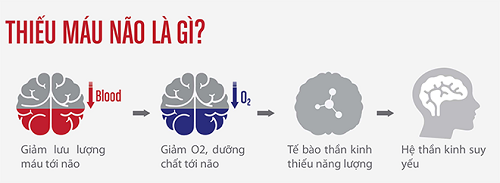 Ngất xỉu do thiếu máu não