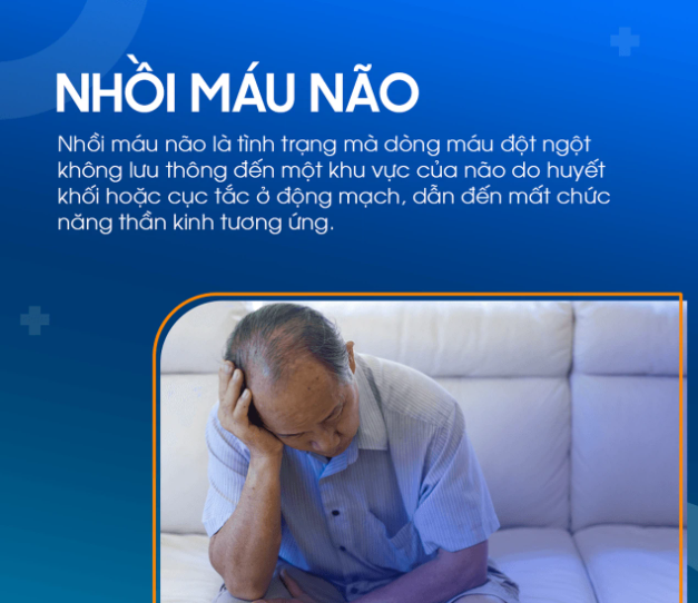 Nhồi máu não ở người cao tuổi: Hiểu đúng nguyên nhân, nhận diện triệu chứng và cách phòng ngừa hiệu quả