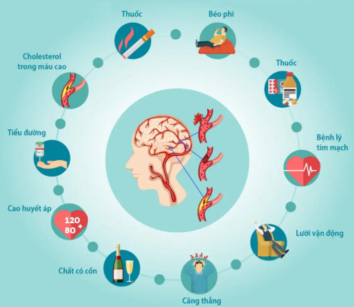 Nhồi máu não ở người cao tuổi