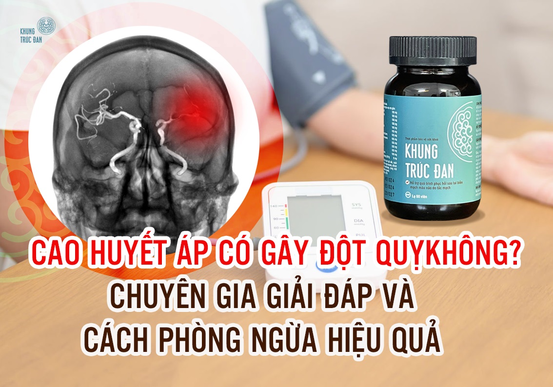 Cao huyết áp có gây đột quỵ không? Mối liên hệ nguy hiểm bạn không được chủ quan